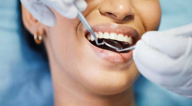 Best Emergency Wisdom Tooth Extraction in Uhland, TX
